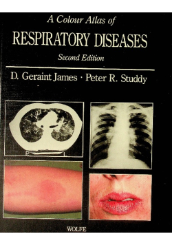 A colour atlas of respiratory diseases