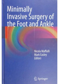 Minimally invasive surgery of the foot and ankle