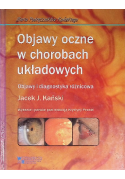 Objawy oczne w chorobach układowych