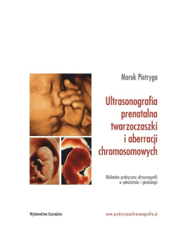 Ultrasonografia prenatalna twarzoczaszki i aberracji chromosomowych