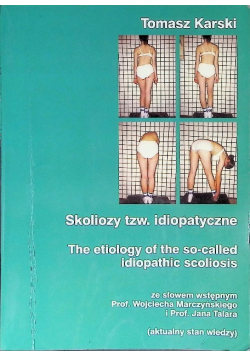 Skoliozy tzw idiopatyczne