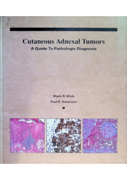 Cutaneous Adnexal Tumors: A Guide to Pathologic Diagnosis