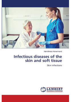 Infectious diseases of the skin and soft tissue