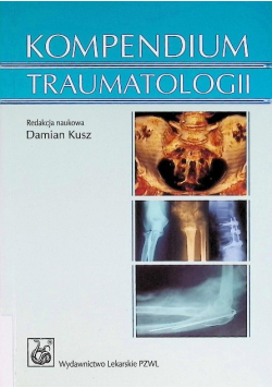 Kompendium traumatologii