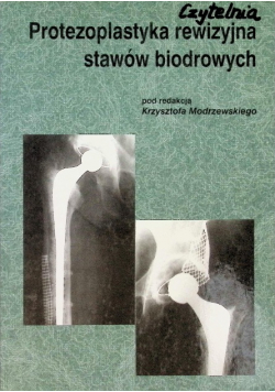 Protezoplastyka rewizyjna stawów biodrowych