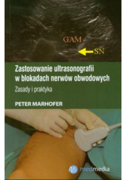 Zastosowanie ultrasonografii w blokadach nerwów obwodowych