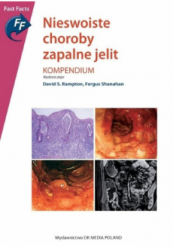 Nieswoiste choroby zapalne jelit Kompendium