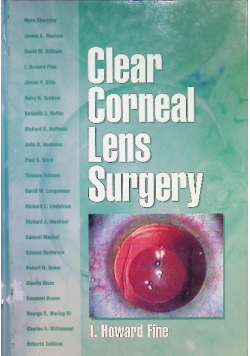 Clear Corneal Lens Surgery