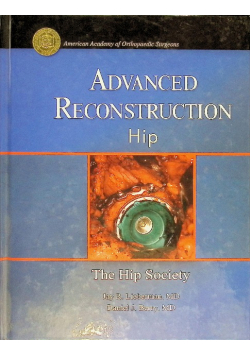 Advanced Reconstruction Hip