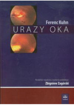 Urazy oka