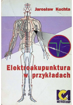 Elektroakupunktura w przykładach