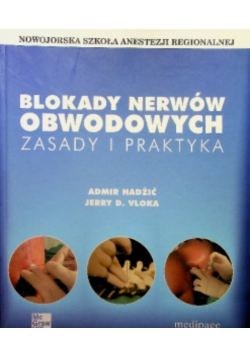 Blokady nerwów obwodowych
