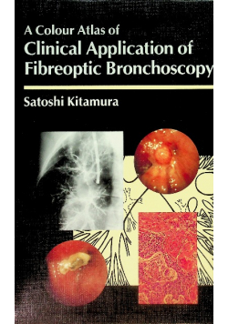 A Colour Atlas of Clinical Application of Fibreoptic Bronchoscopy