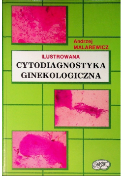 Cytodiagnostyka ginekologiczna
