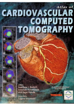 Cardiovascular Computed Tomography
