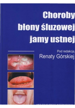 Choroby błony śluzowej jamy ustnej