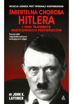 Śmiertelna choroba Hitlera i inne tajemnice nazistowskich przywódców