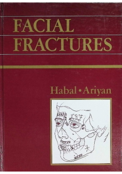 Facial Fractures