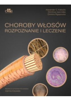 Choroby włosów Rozpoznanie i leczenie