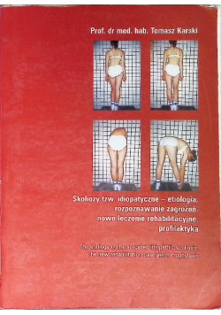 Skoliozy tzw. idiopatyczne etiologia rozpoznawanie zagrożeń nowe leczenie rehabilitacyjne profilaktyka