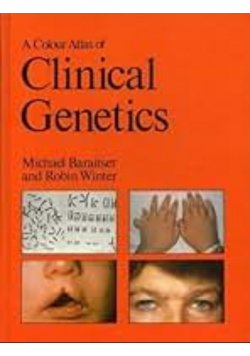 A colour atlas of clinical genetics