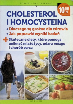 Cholesterol i homocysteina – dlaczego są groźne dla zdrowia Nr 4/21
