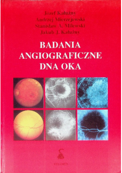 Badania angiograficzne dna oka