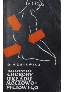 Najczęstsze choroby układu moczowo płciowego