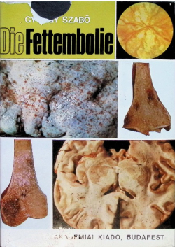 Die Fettembolie
