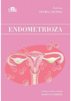 Endometrioza