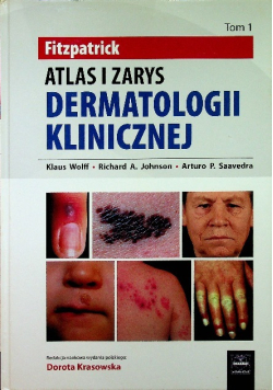 Fitzpatrick Tom 1 Atlas i zarys dermatologii klinicznej