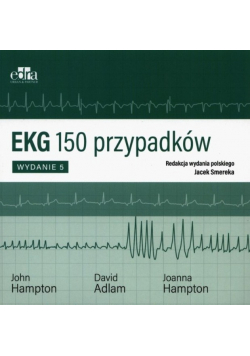 EKG 150 przypadków
