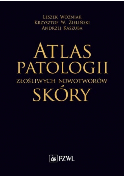 Atlas patologii złośliwych nowotworów skóry