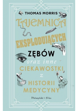Tajemnica eksplodujących zębów oraz inne ciekawostki z historii medycyny