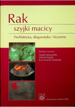 Rak szyjki macicy