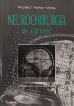 Neurochirurgia w zarysie