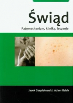 Świąd Patomechanizm klinika leczenie