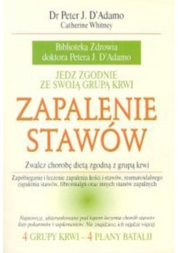Zapalenie stawów