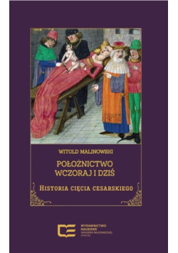 Położnictwo wczoraj i dziś. Historia cięcia cesarskiego