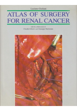 Atlas of surgery for renal cancer. Second edition.