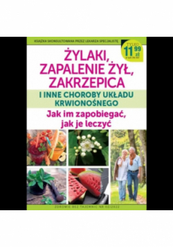Żylaki zapalenie żył zakrzepica i inne choroby