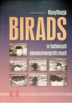 Klasyfikacja birads w badaniach sonograficznych