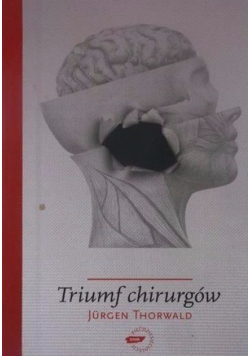Triumf chirurgów