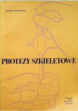 Protezy szkieletowe