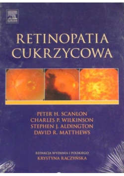 Retinopatia cukrzycowa