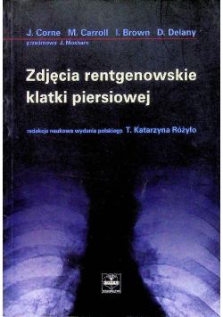 Zdjecie rentgenowskie klatki piersiowej
