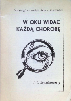 W oku widać każdą chorobę