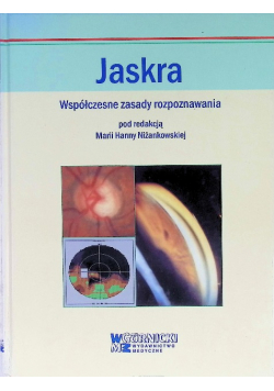 Jaskra Współczesne zasady rozpoznawania