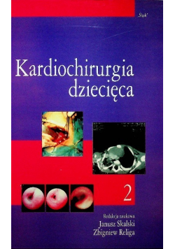 Kardiochirurgia dziecięca Tom II