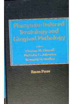 Phenytoin-induced teratology and gingival pathology
